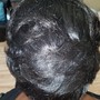 Scalp Treatment for Dandruff