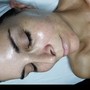 OxiSmooth Oxygen Facial