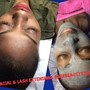 Mens Custom Ingrown Facial