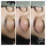 Inner Nose Wax