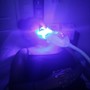 Microdermabrasion with LED