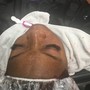 Low Level Laser Hair Regrowth