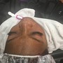 Low Level Laser Hair Regrowth