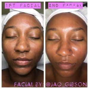 About Facial Spa La - Los Angeles Ca - Facebook thumbnail