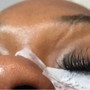 HydraFacial