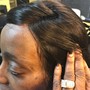 Scalp Treatment