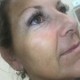 HydraFacial