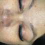 Face Sugaring Full Face