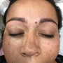 Beard Fill-In Microblading 