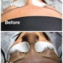 Eyelash Extension Removal