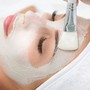 Diamond Microdermabrasion