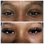 Lash removal