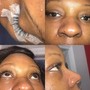 Eyelash Extension Removal