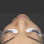 Eyelash Extension Removal