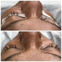 Eyelash Extension Removal