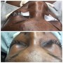 Eyelash Extension Removal