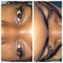 Hybrid lash set