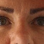 Undereyes Bags