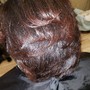 Scalp Treatment for Dandruff