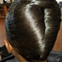 Hair loss Consultation