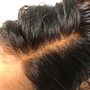 Scalp Balancing  Treatment