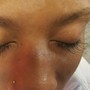 Eyelash Extension Removal