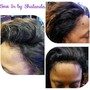 ((Add on Service) Scalp Treatment