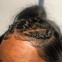 Scalp Treatment