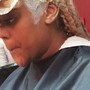 Scalp Treatment