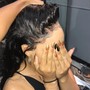 Scalp Treatment