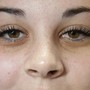 Eyelash Extension Removal