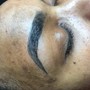 Dermaplaning