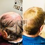 Virtual HAIR LOSS Consultation