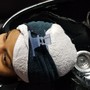 Oxygen Scalp Treatment