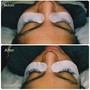 Eyelash Extension Removal