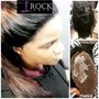 Dandruff scalp treatment