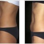 Skinny Lipo Shots