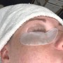 HydraFacial