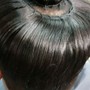 Scalp Treatment