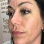 Eyelash Extension Removal