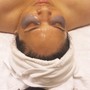 Acne Facial