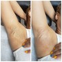 Brazilian Wax Using Sugar Wax