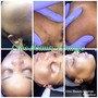 Dermaplaning Egyptian facial