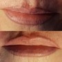 Lip Conditioning Treatment