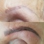 Age Smart Resurfacing peel