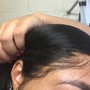 Scalp treatment