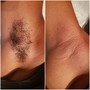 Brazilian Sugaring