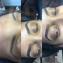 Dermaplaning