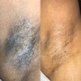 Brazilian Wax, Underarm Wax