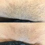 Men’s Brazilian Wax